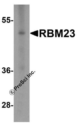 Western blot analysis of RBM23 in (A) human tonsil and (B) rat stomach tissue lysate with RBM23 antibody at 1 μg/mL.