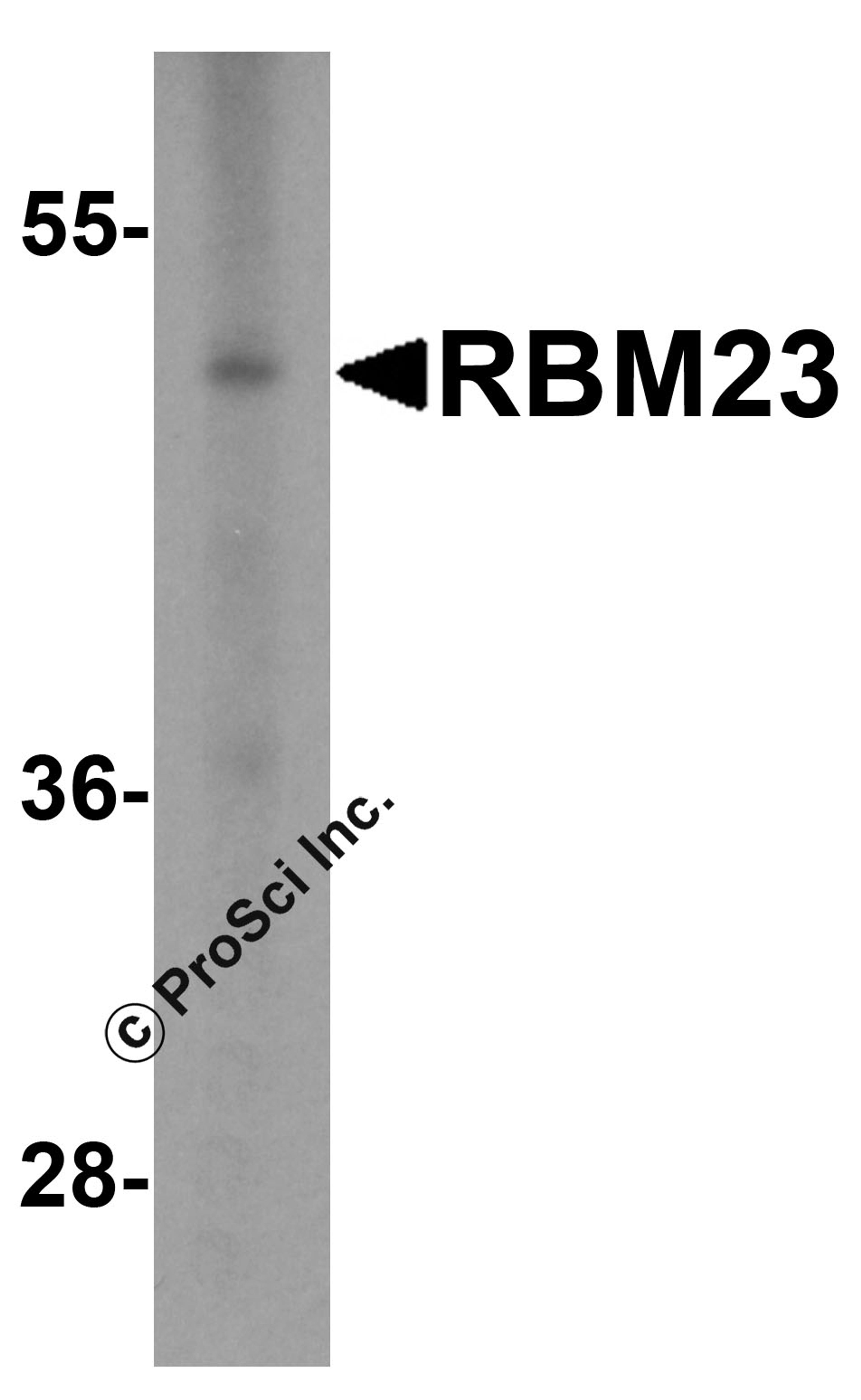 Western blot analysis of RBM23 in (A) human tonsil and (B) rat stomach tissue lysate with RBM23 antibody at 1 μg/mL.