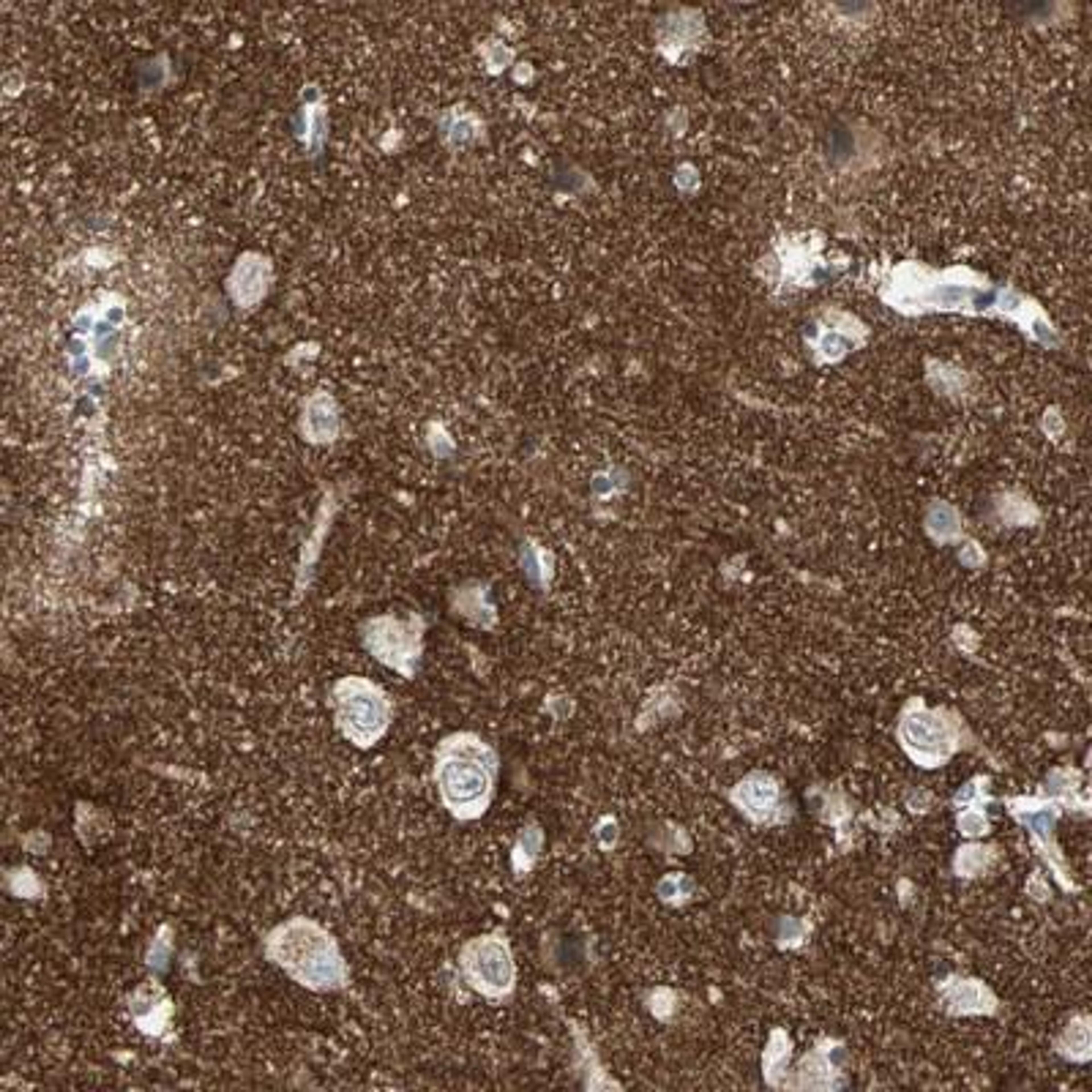 Immunohistochemistry: Brevican Antibody [NBP1-89992] - Immunohistochemical staining of human hippocampus shows strong positivity in neuropil.