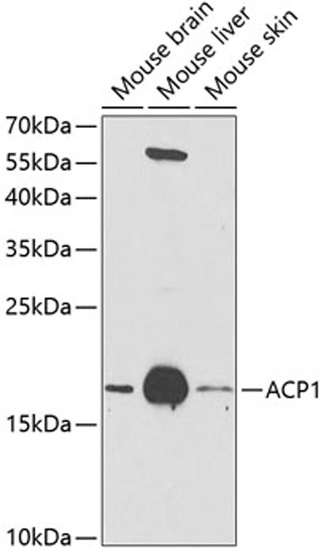 Western blot - ACP1 antibody (A1801)