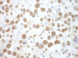 Detection of mouse SF3B3 by immunohistochemistry.