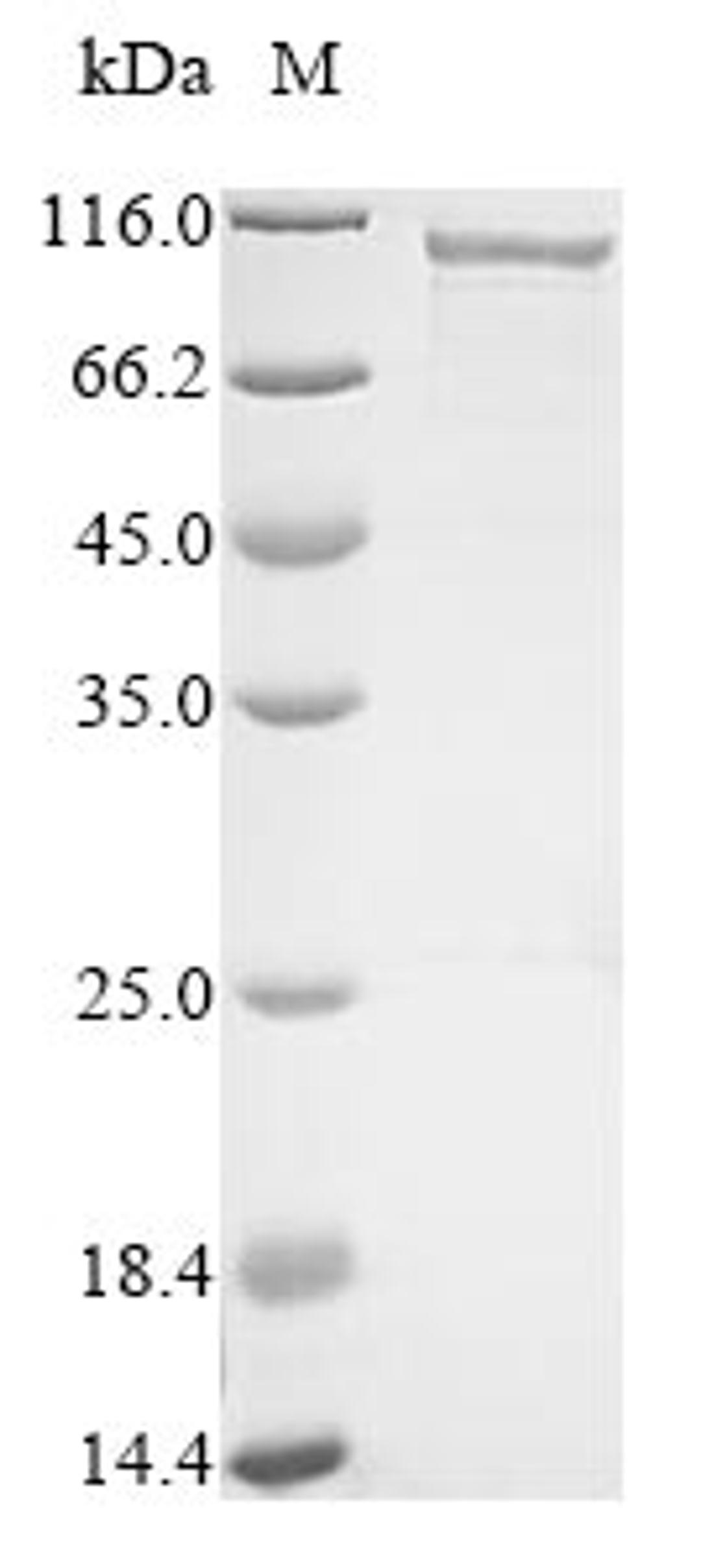 (Tris-Glycine gel) Discontinuous SDS-PAGE (reduced) with 5% enrichment gel and 15% separation gel.