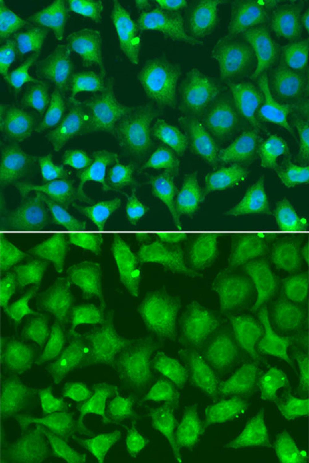 Immunofluorescence - XRCC2 antibody (A13639)