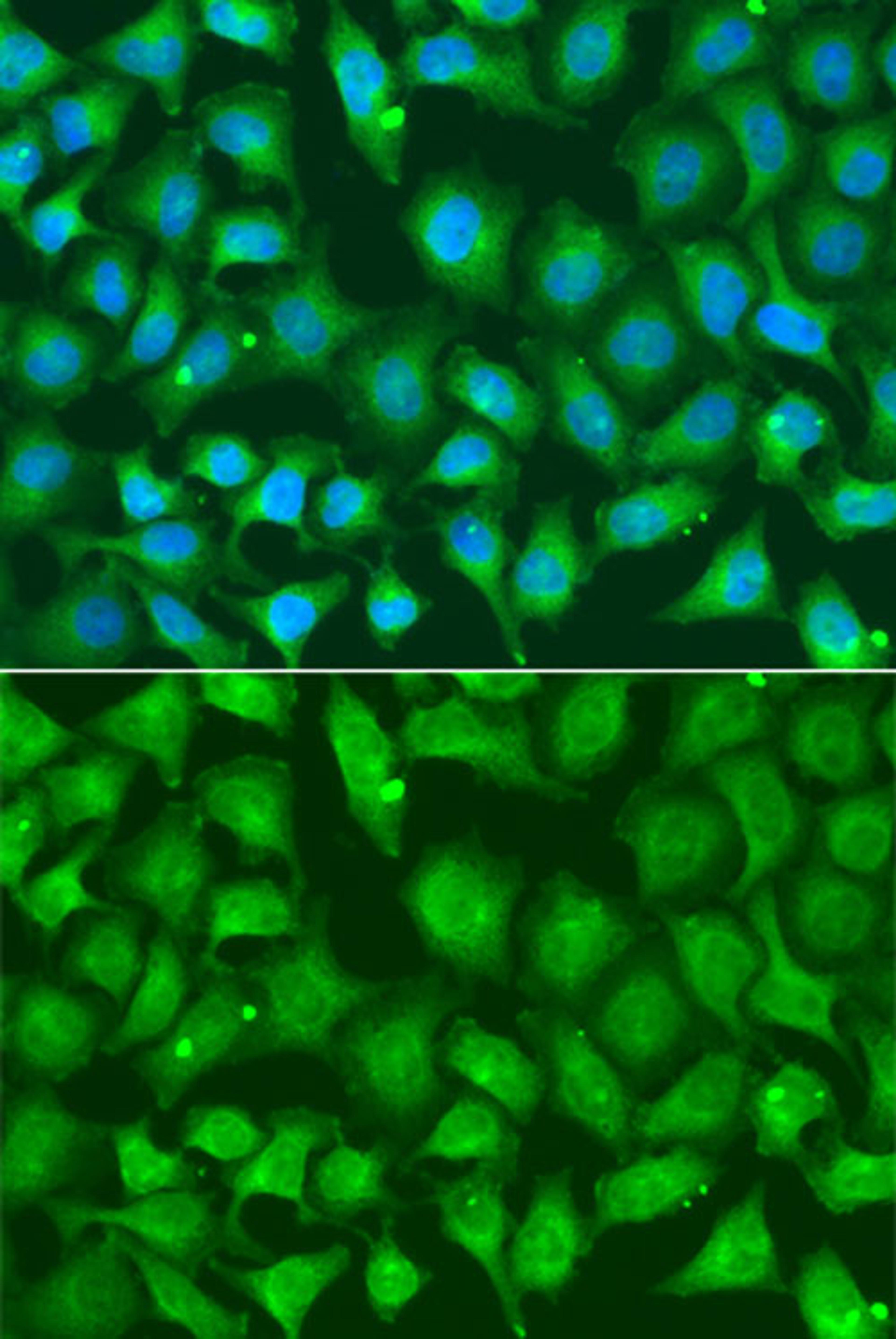 Immunofluorescence - XRCC2 antibody (A13639)