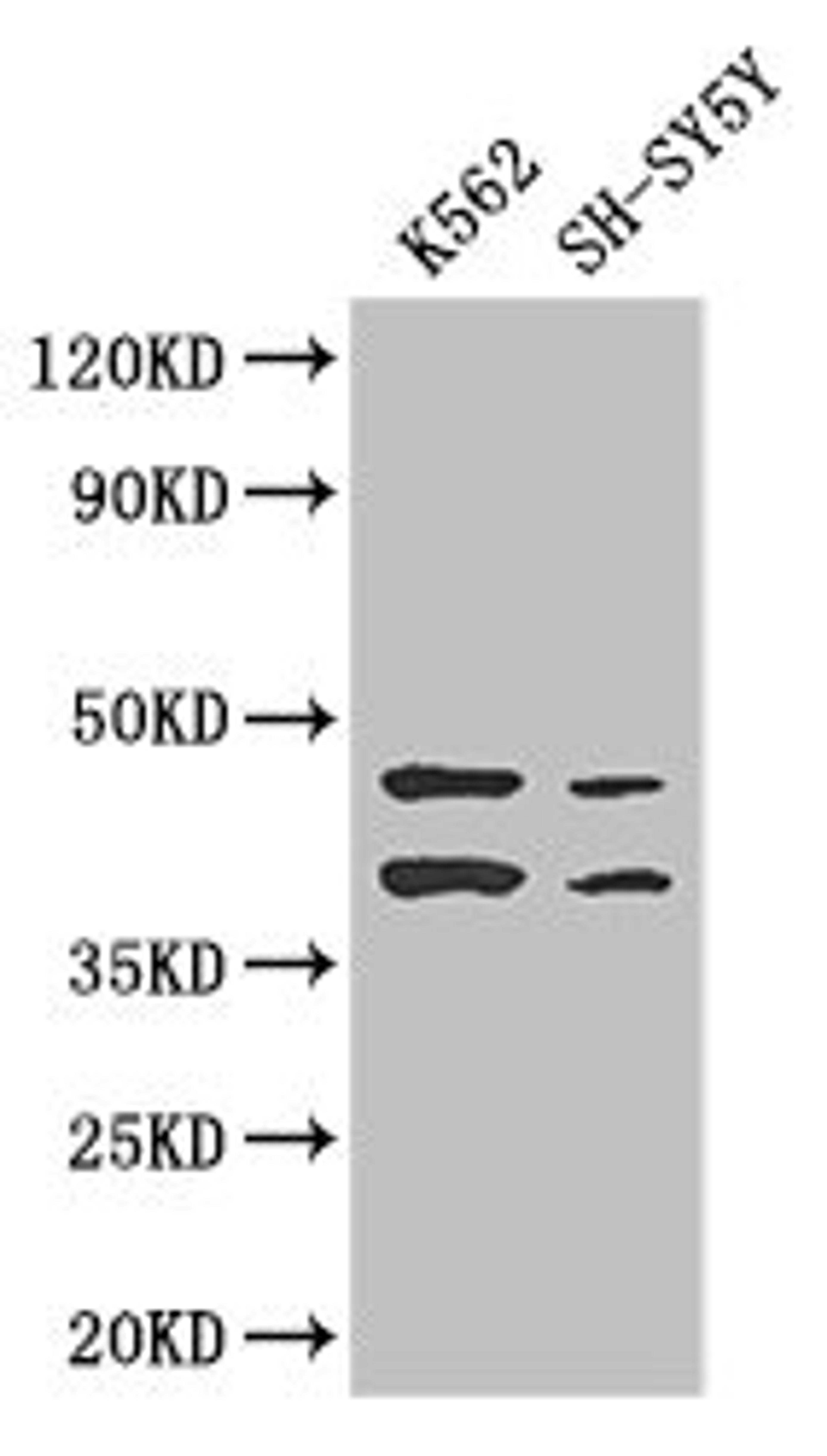 Western Blot. Positive WB detected in: K562 whole cell lysate, SH-SY5Y whole cell lysate. All lanes: AIM2 antibody at 2.7ug/ml. Secondary. Goat polyclonal to rabbit IgG at 1/50000 dilution. Predicted band size: 39 kDa. Observed band size: 39, 45 kDa.