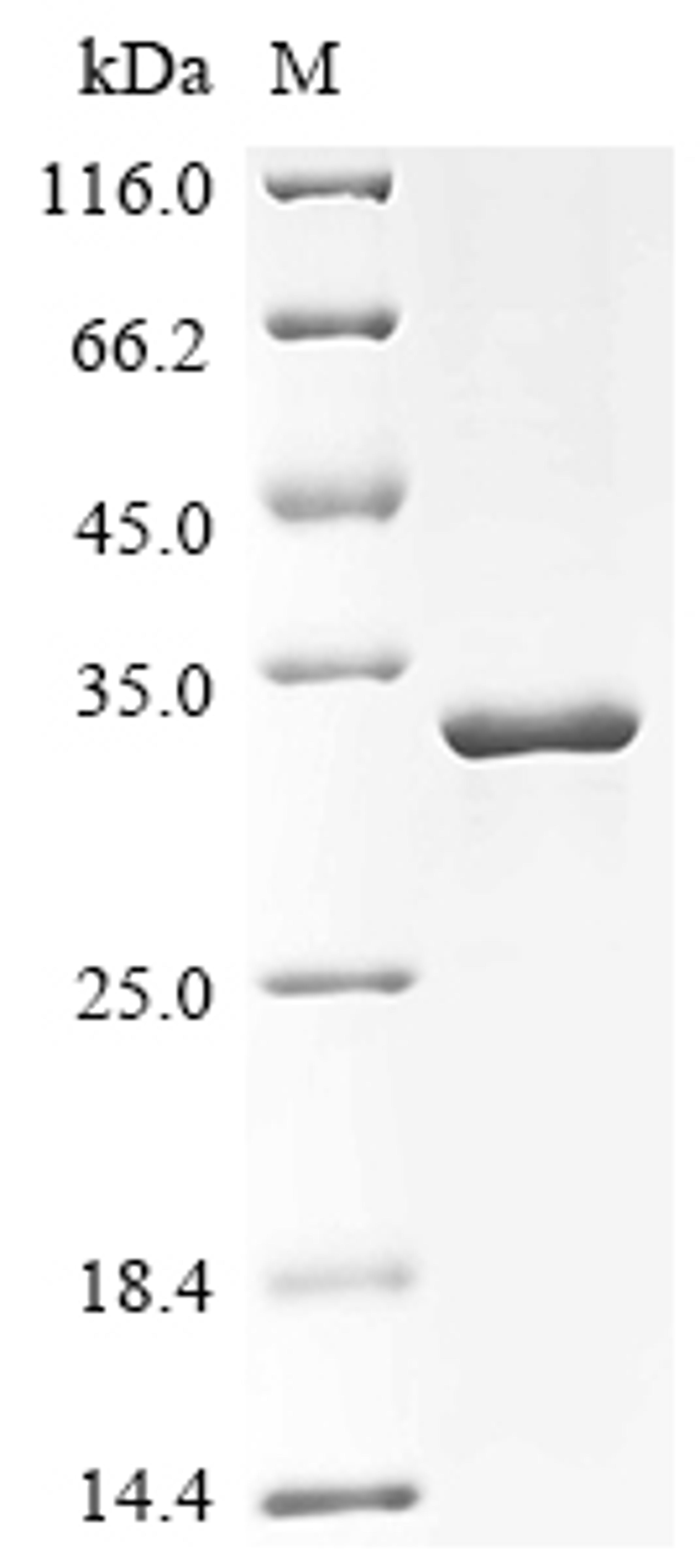 (Tris-Glycine gel) Discontinuous SDS-PAGE (reduced) with 5% enrichment gel and 15% separation gel.