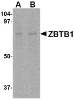 Western blot analysis of ZBTB1 in HepG2 lysate with ZBTB1 antibody at (A) 1 and (B) 2 &#956;g/mL.