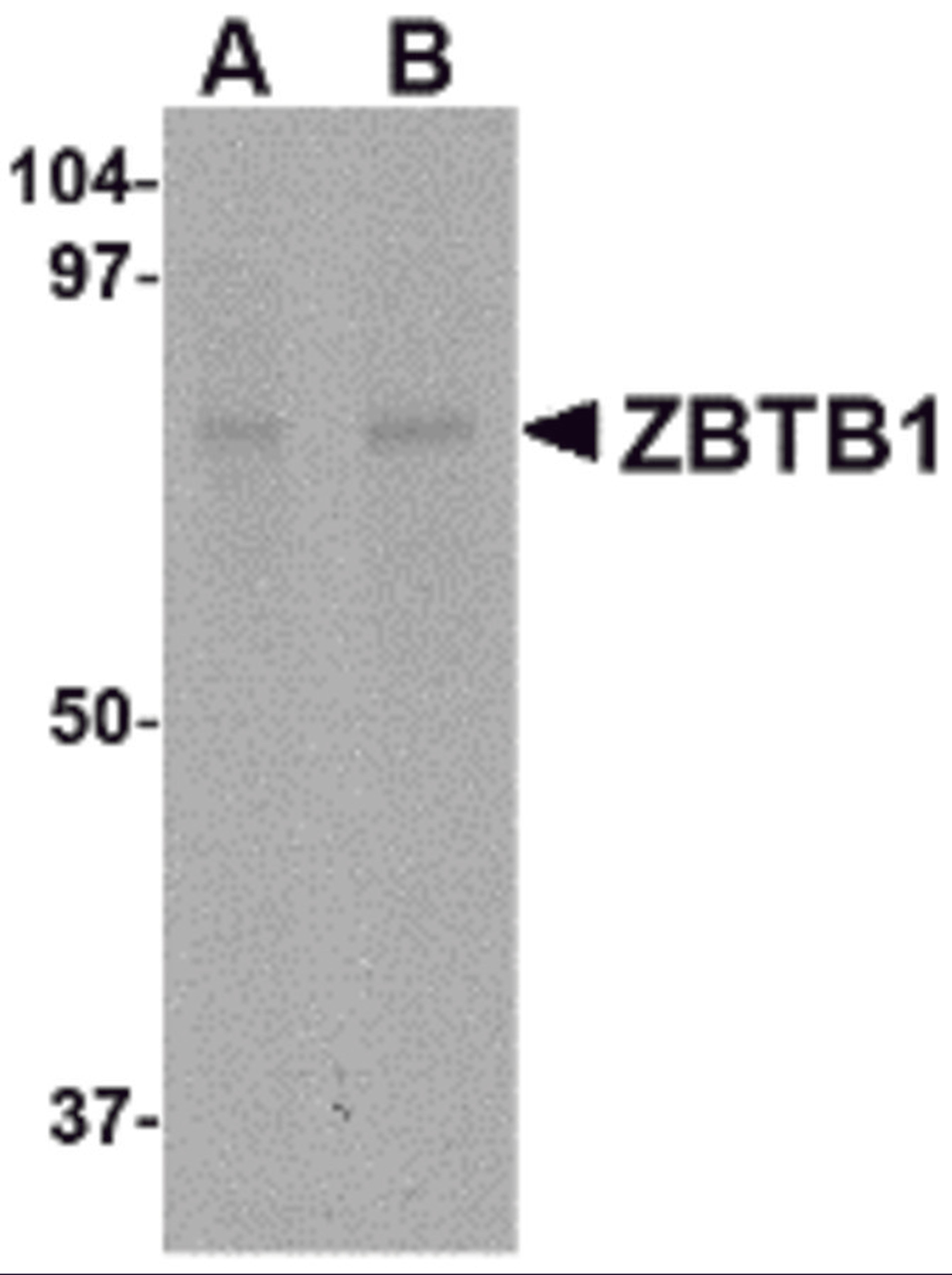 Western blot analysis of ZBTB1 in HepG2 lysate with ZBTB1 antibody at (A) 1 and (B) 2 &#956;g/mL.