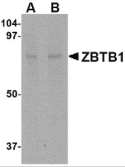 Western blot analysis of ZBTB1 in HepG2 lysate with ZBTB1 antibody at (A) 1 and (B) 2 μg/mL.