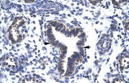 Antibody used in IHC on Human Lung at 4.0-8.0 ug/ml.