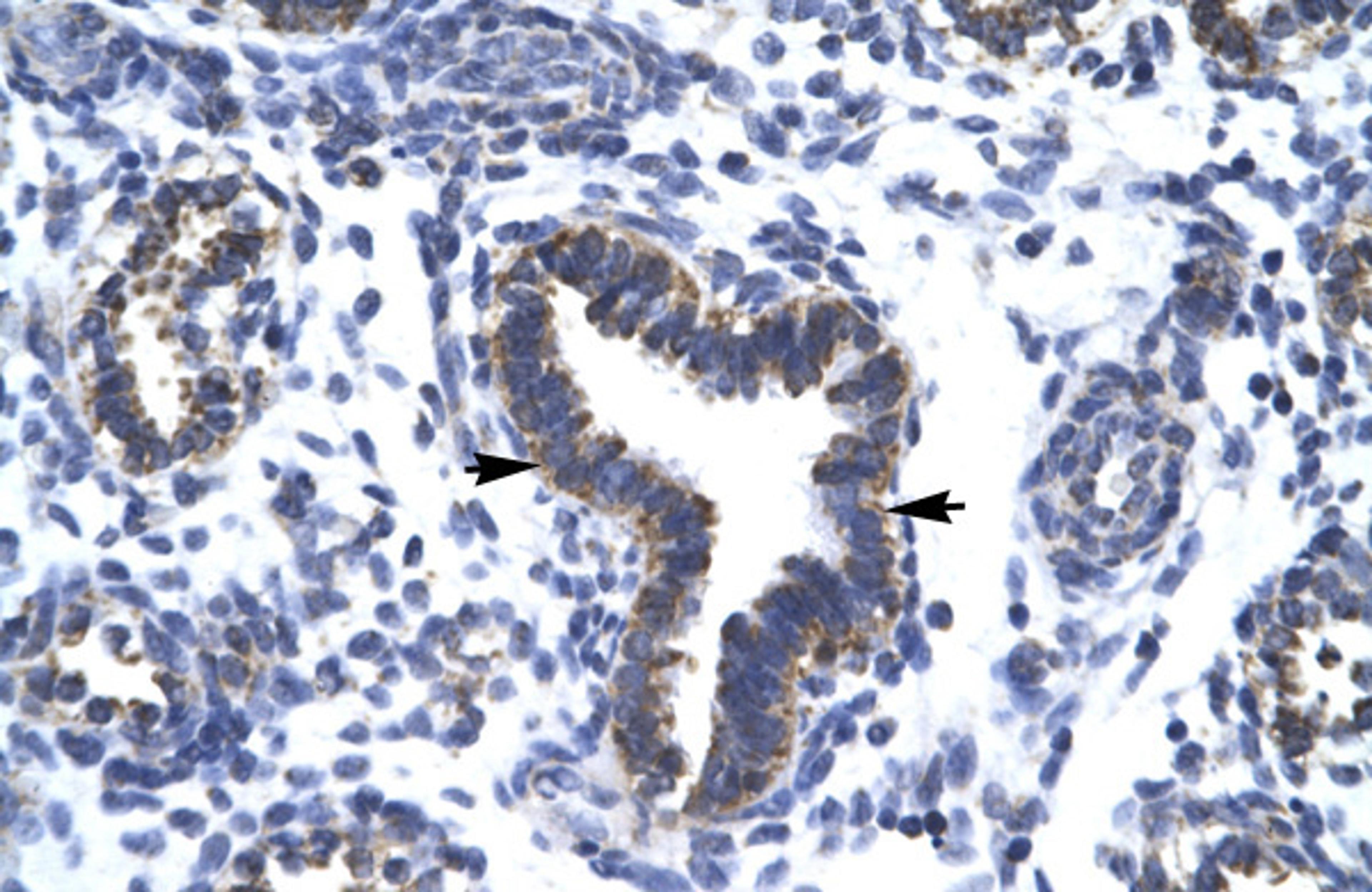 Antibody used in IHC on Human Lung at 4.0-8.0 ug/ml.