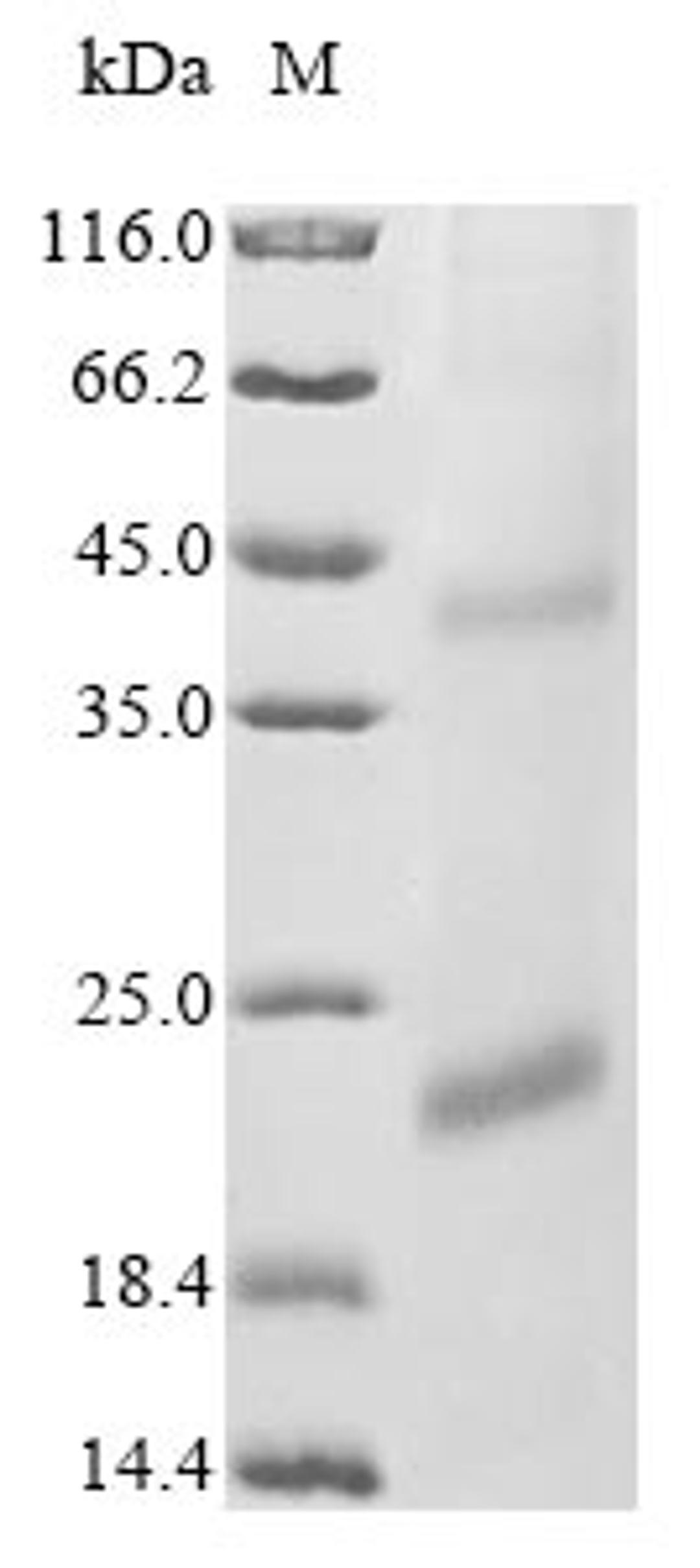 (Tris-Glycine gel) Discontinuous SDS-PAGE (reduced) with 5% enrichment gel and 15% separation gel.