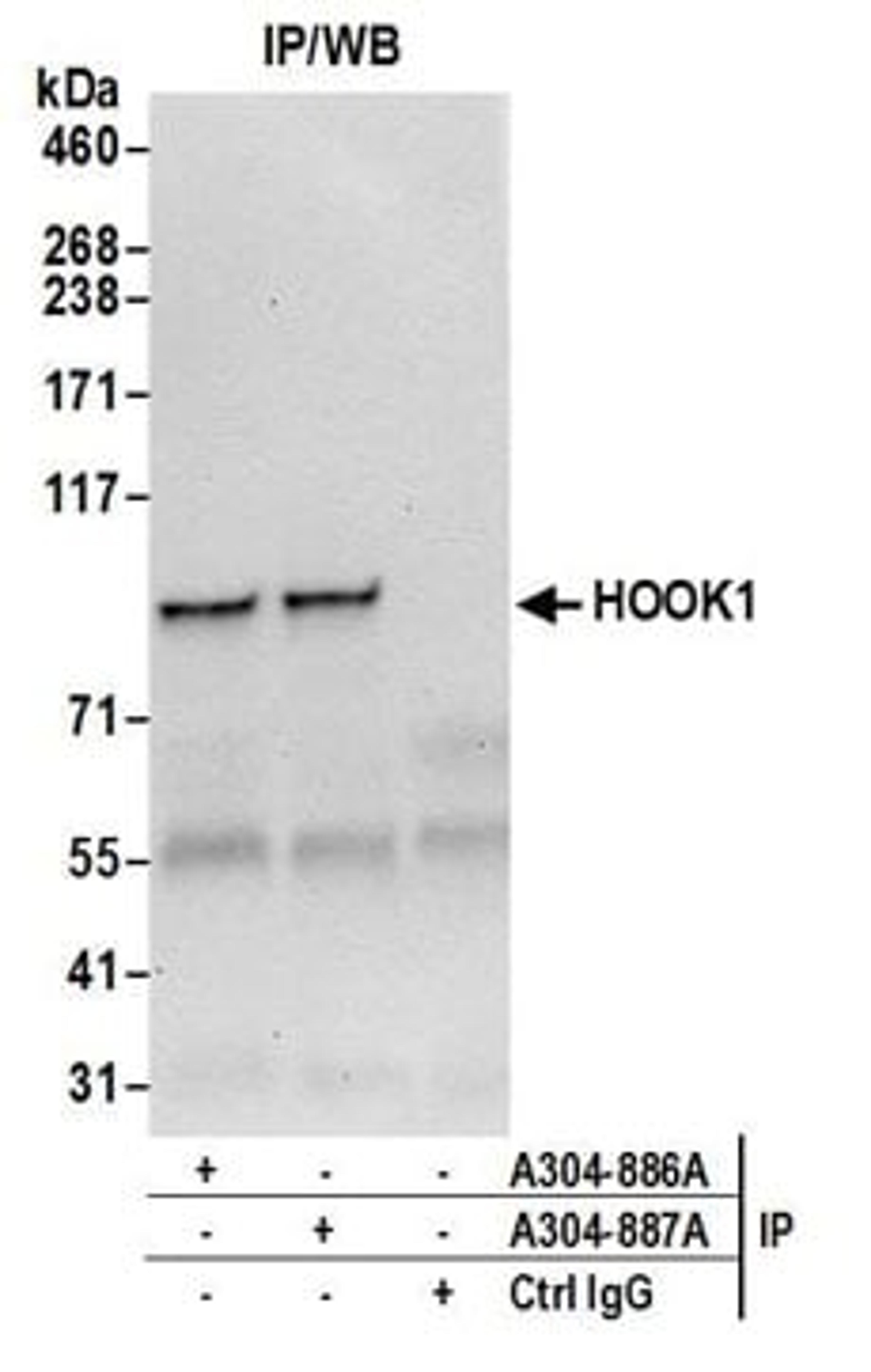 Detection of human HOOK1 by western blot of immunoprecipitates.