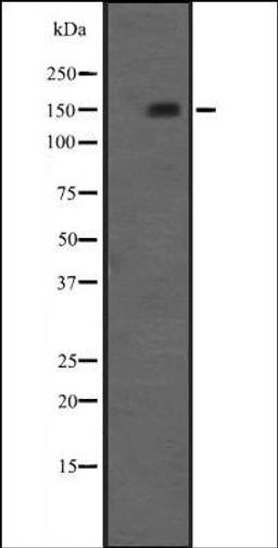 Western blot analysis of A498 human Kidney Carcinoma Whole Cell Lysate using NRIP1 antibody