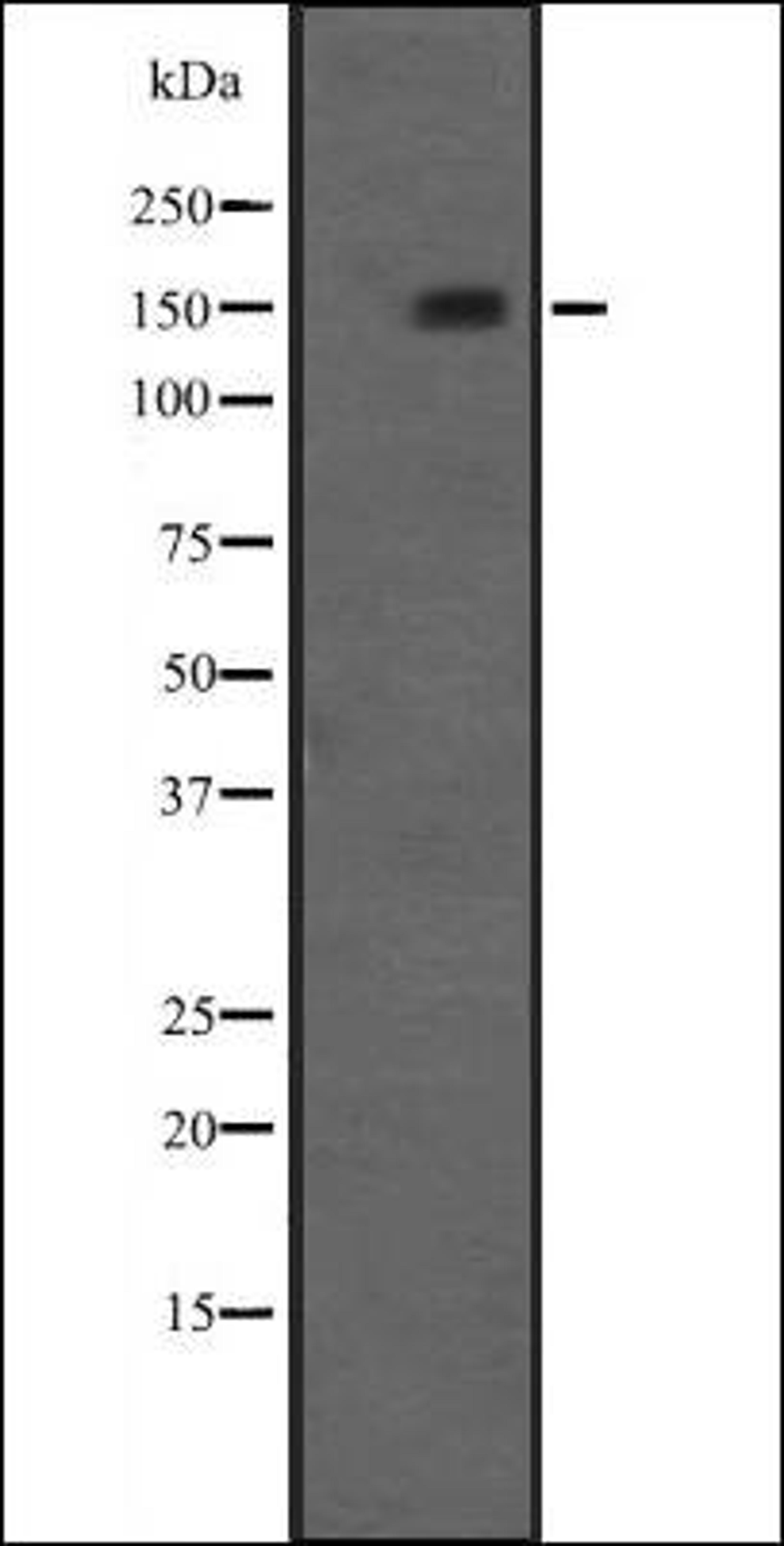 Western blot analysis of A498 human Kidney Carcinoma Whole Cell Lysate using NRIP1 antibody