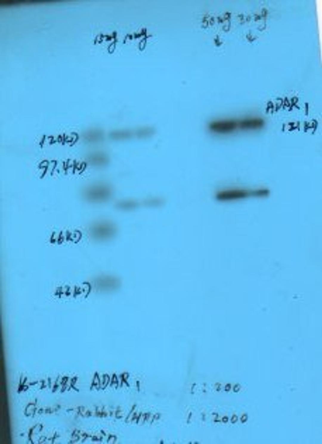 Western Blot using ADAR1 antibody on rat brain