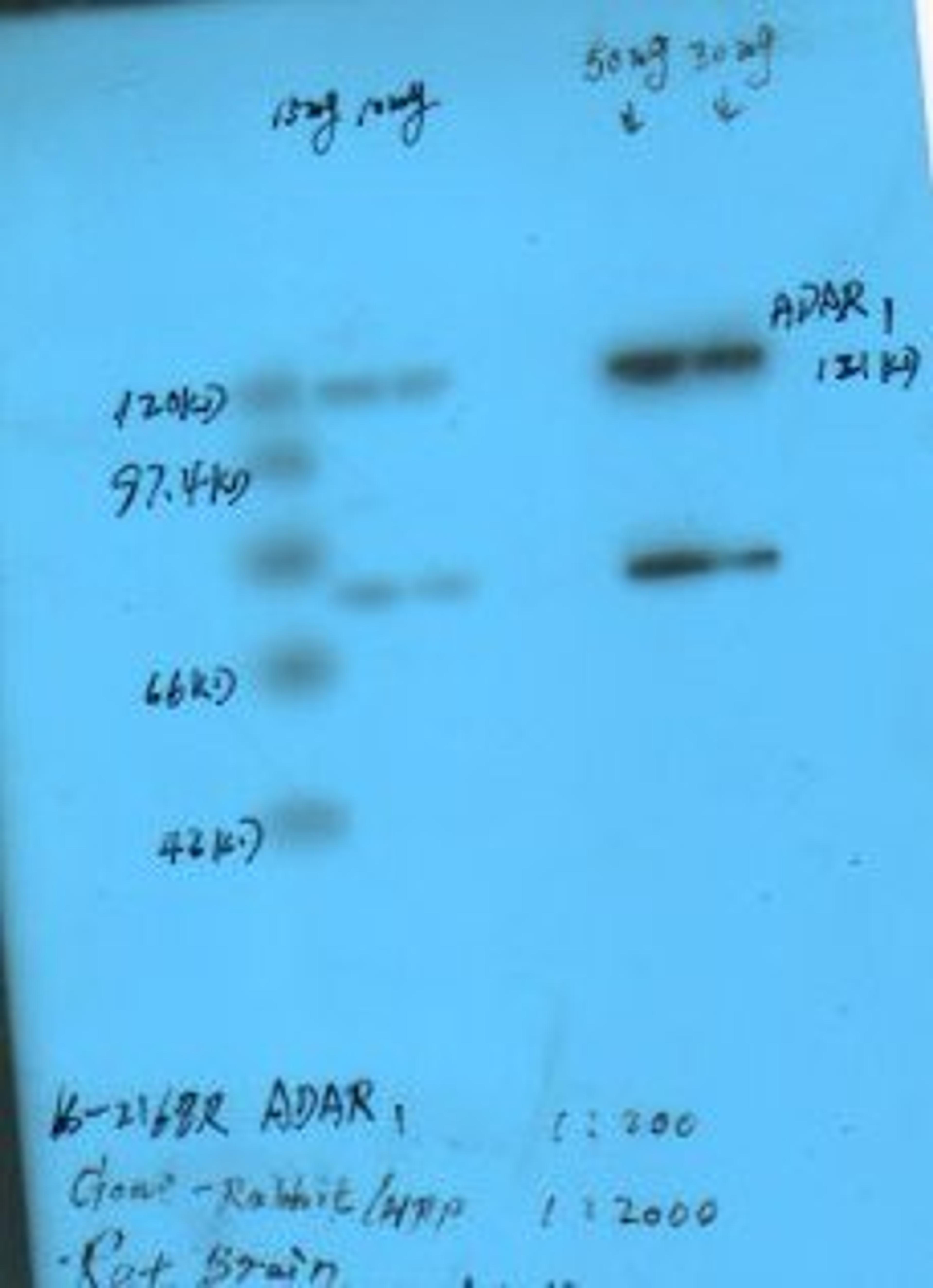 Western Blot using ADAR1 antibody on rat brain