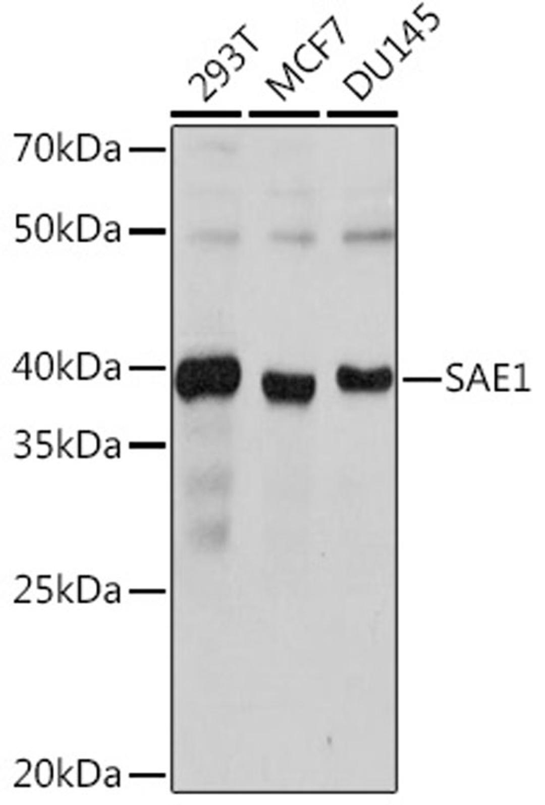 Western blot - SAE1 Rabbit mAb (A0891)