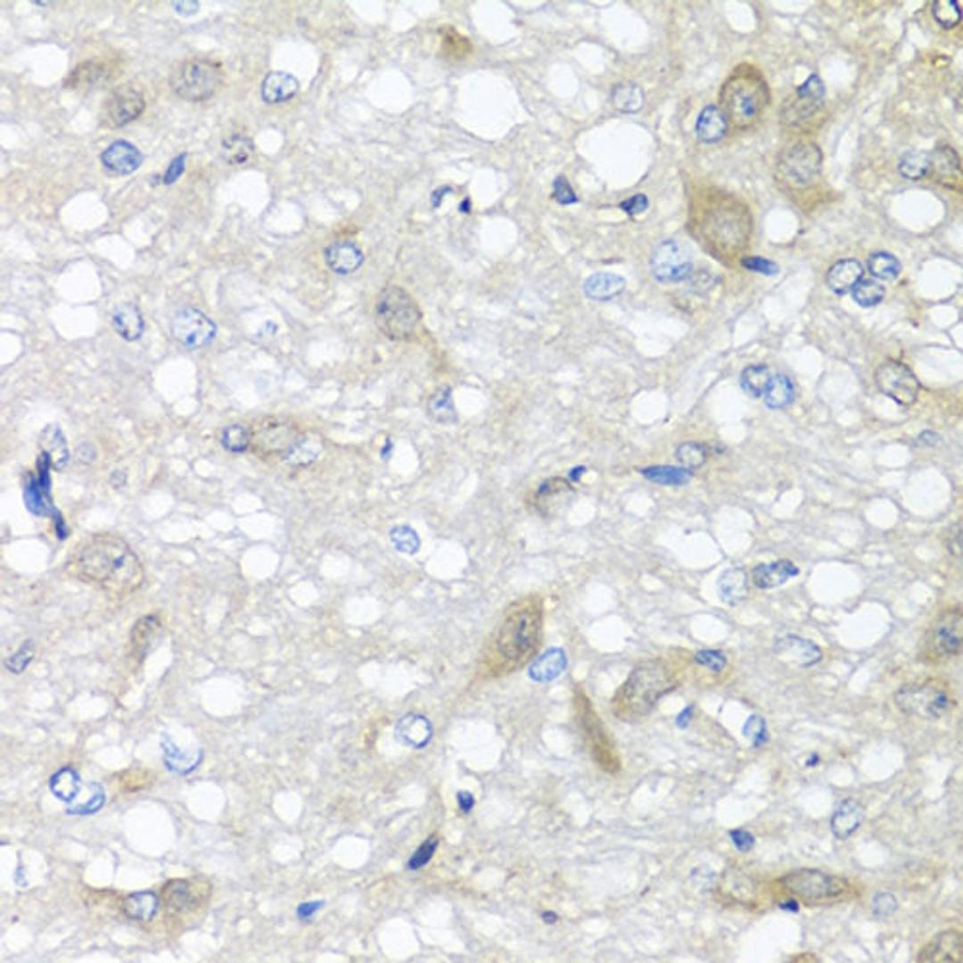 Immunohistochemistry  - IL6 antibody (A11114)