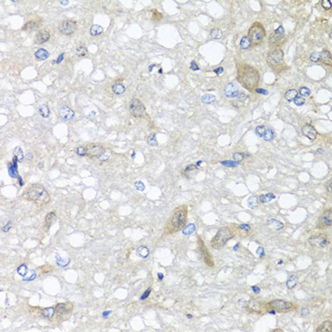 Immunohistochemistry - IL6 antibody (A11114)