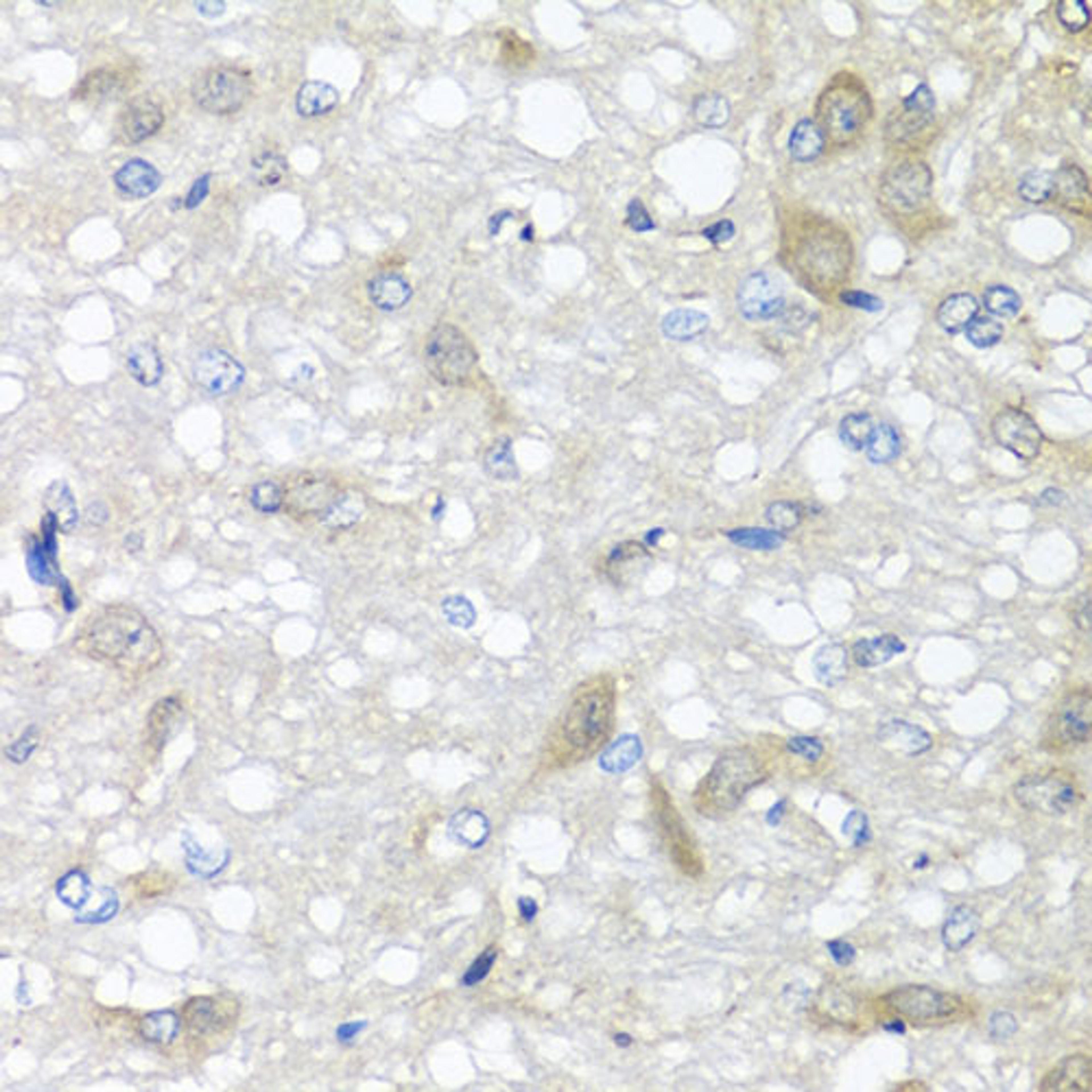 Immunohistochemistry - IL6 antibody (A11114)