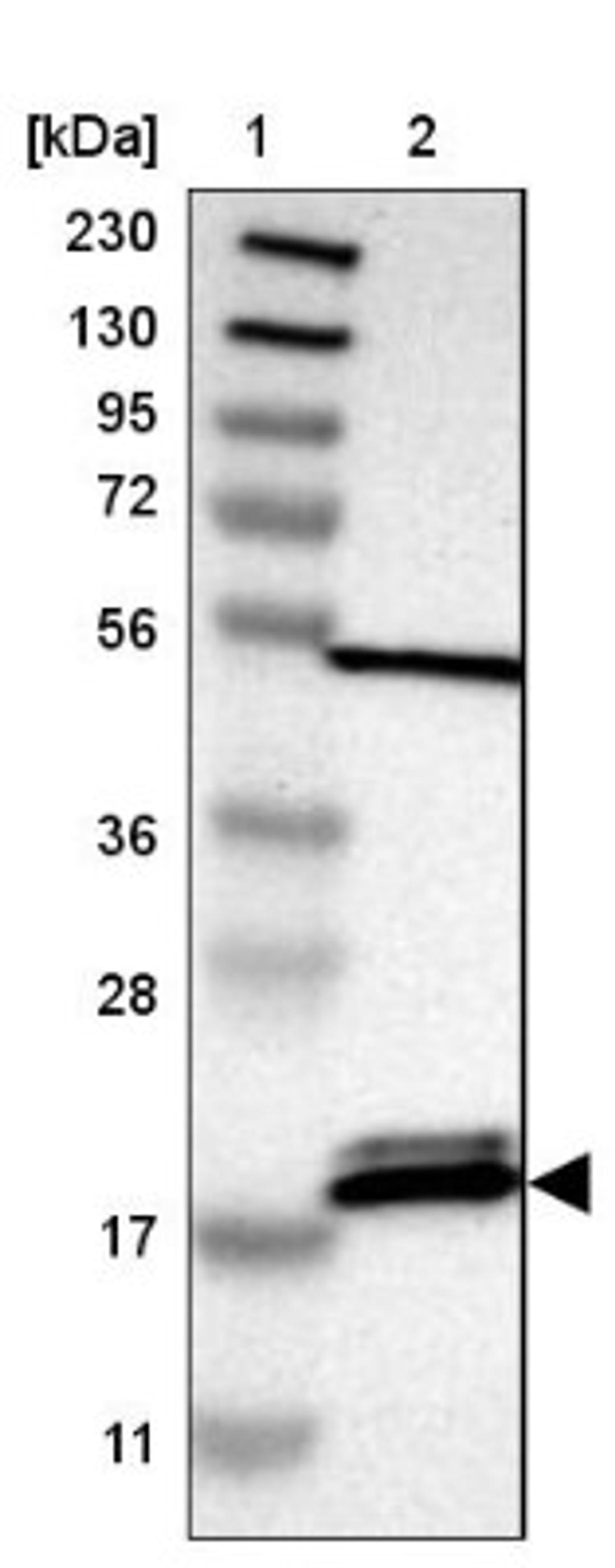 Western Blot: PTRH2 Antibody [NBP1-88595] - Lane 1: Marker [kDa] 230, 130, 95, 72, 56, 36, 28, 17, 11<br/>Lane 2: Human cell line RT-4