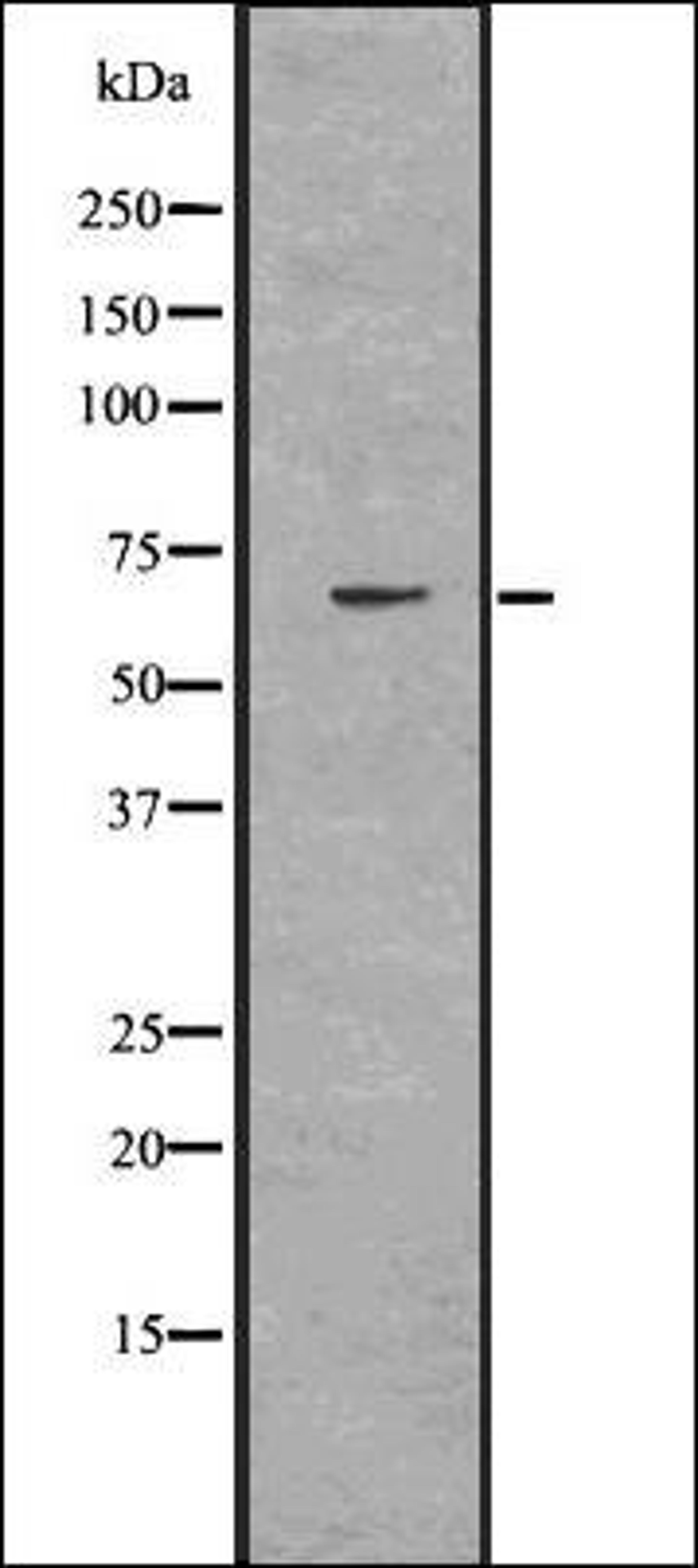 Western blot analysis of HuvEc whole cell lysates using FATP1 antibody