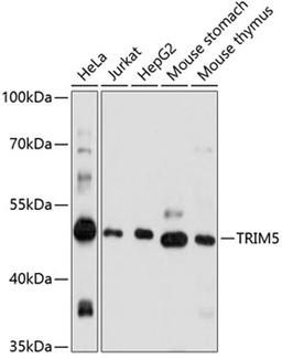 Western blot - TRIM5 antibody (A1872)