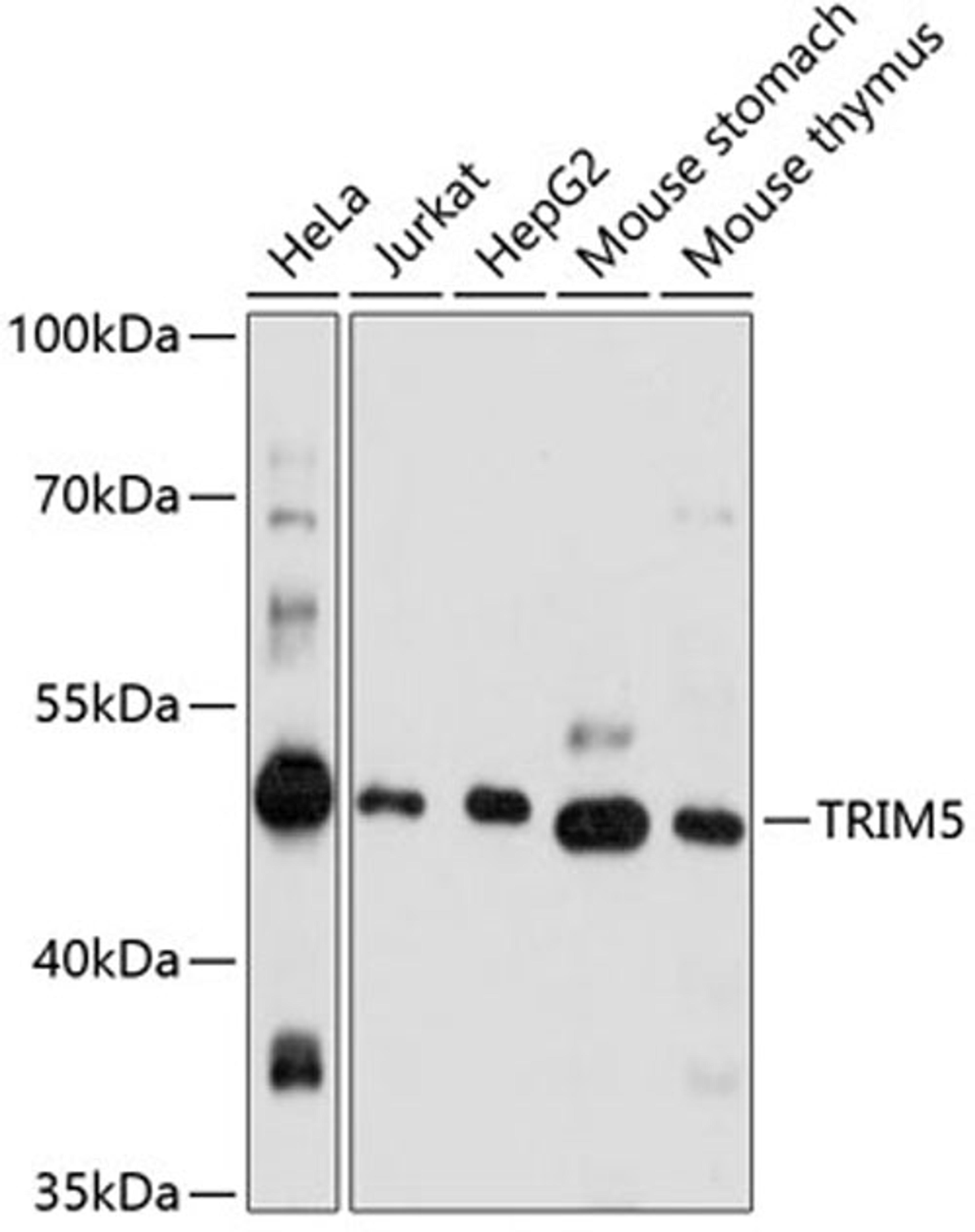 Western blot - TRIM5 antibody (A1872)