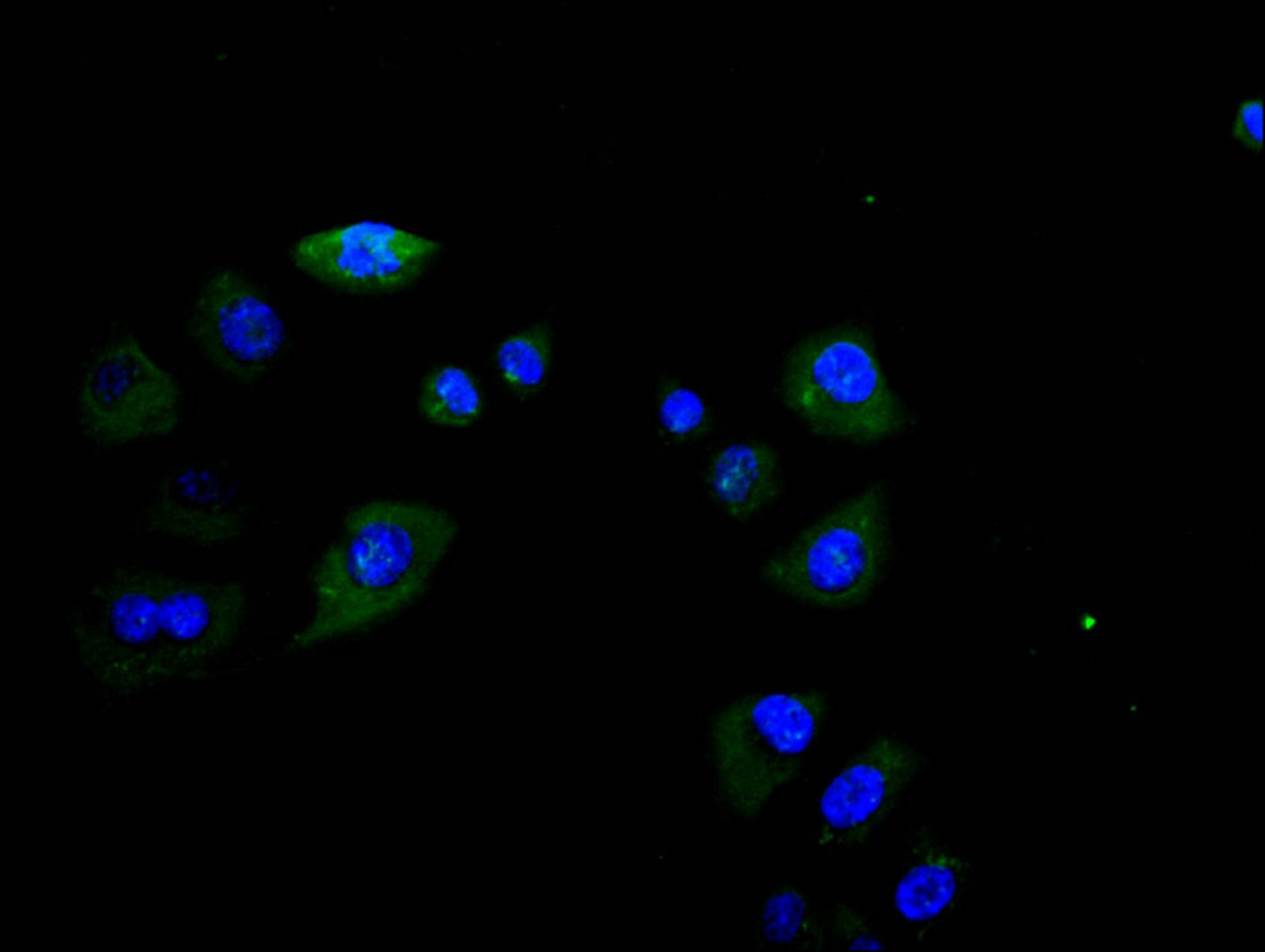 Immunofluorescence staining of Hela cell with CSB-RA008543MA1HU at 1:30, counter-stained with DAPI. The cells were fixed in 4% formaldehyde and blocked in 10% normal Goat Serum. The cells were then incubated with the antibody overnight at 4C. The secondary antibody was Alexa Fluor 488-congugated AffiniPure Goat Anti-Rabbit IgG(H+L).