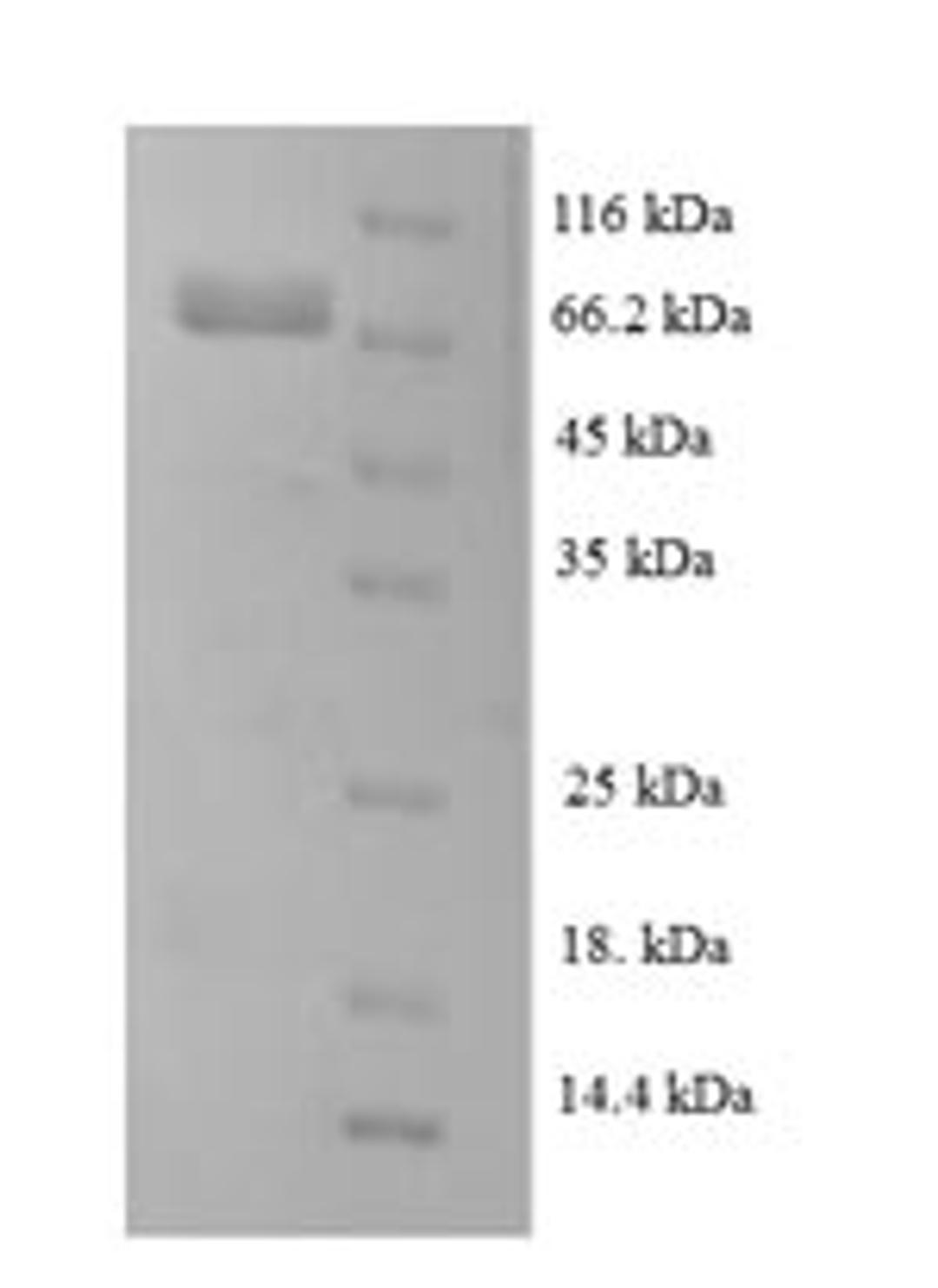(Tris-Glycine gel) Discontinuous SDS-PAGE (reduced) with 5% enrichment gel and 15% separation gel.