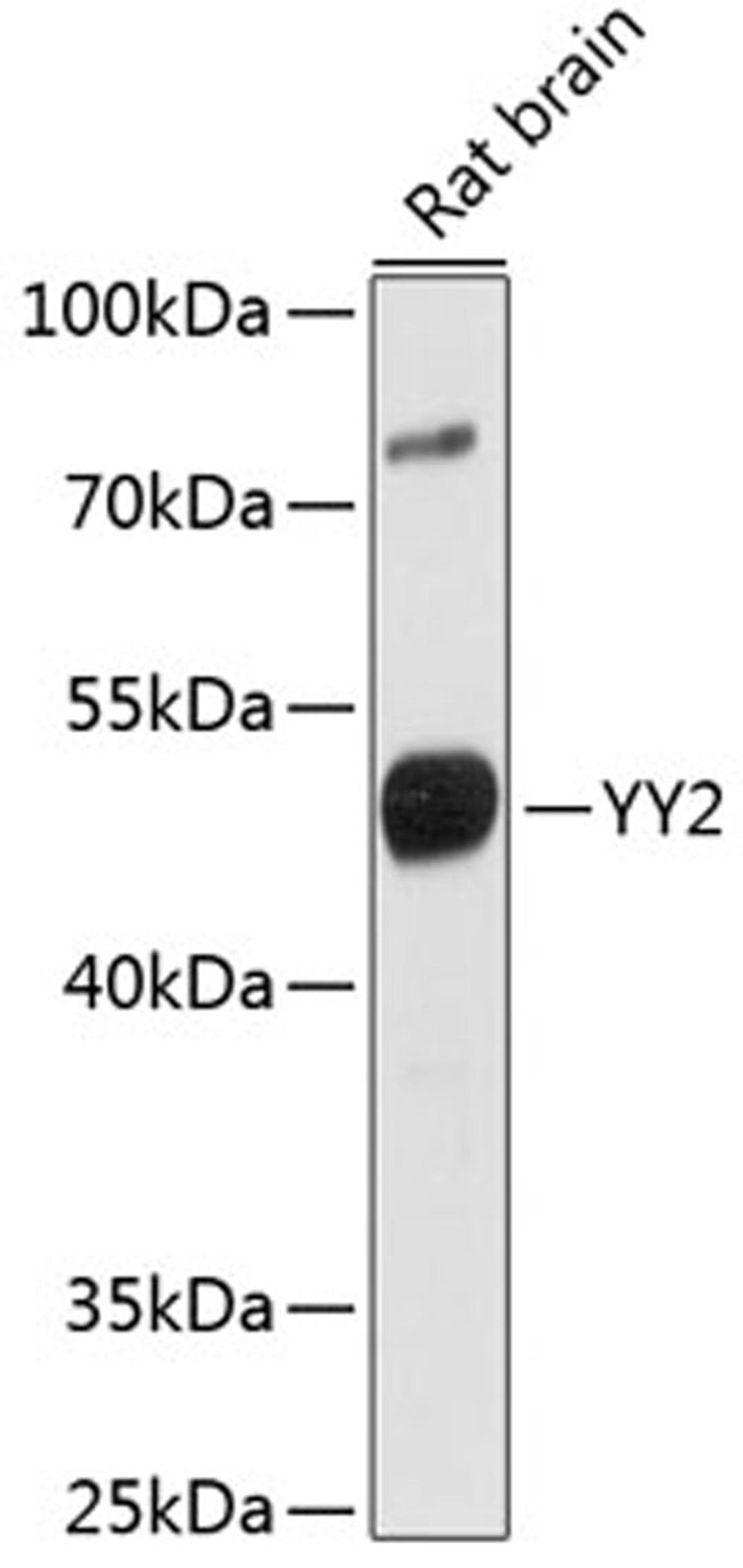 Western blot - YY2 antibody (A16621)