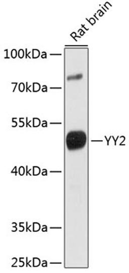 Western blot - YY2 antibody (A16621)