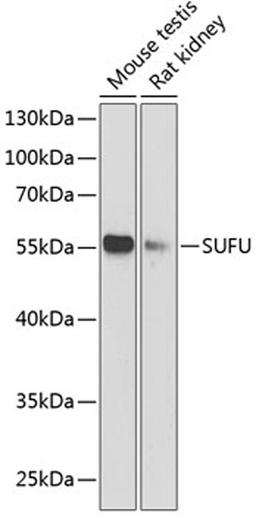 Western blot - SUFU antibody (A13429)