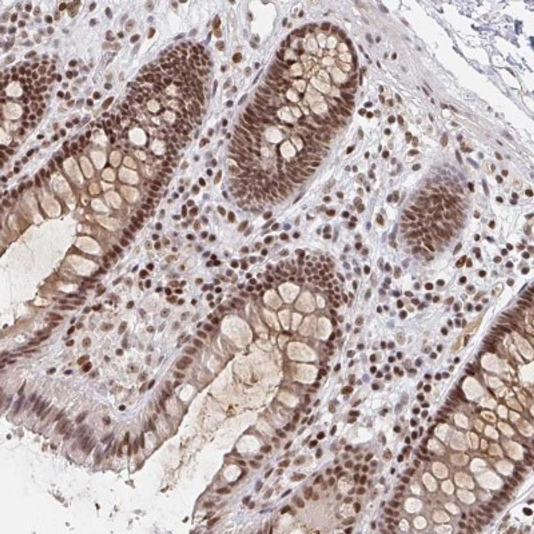 Immunohistochemistry: H1FX Antibody [NBP2-31980] - Immunohistochemical staining of human colon shows moderate nuclear positivity in glandular cells.