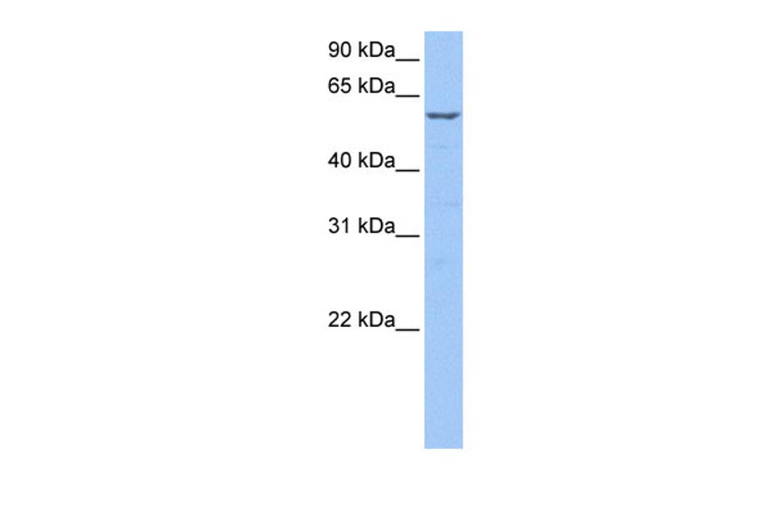 Antibody used in WB on Human Jurkat 0.2-1 ug/ml.