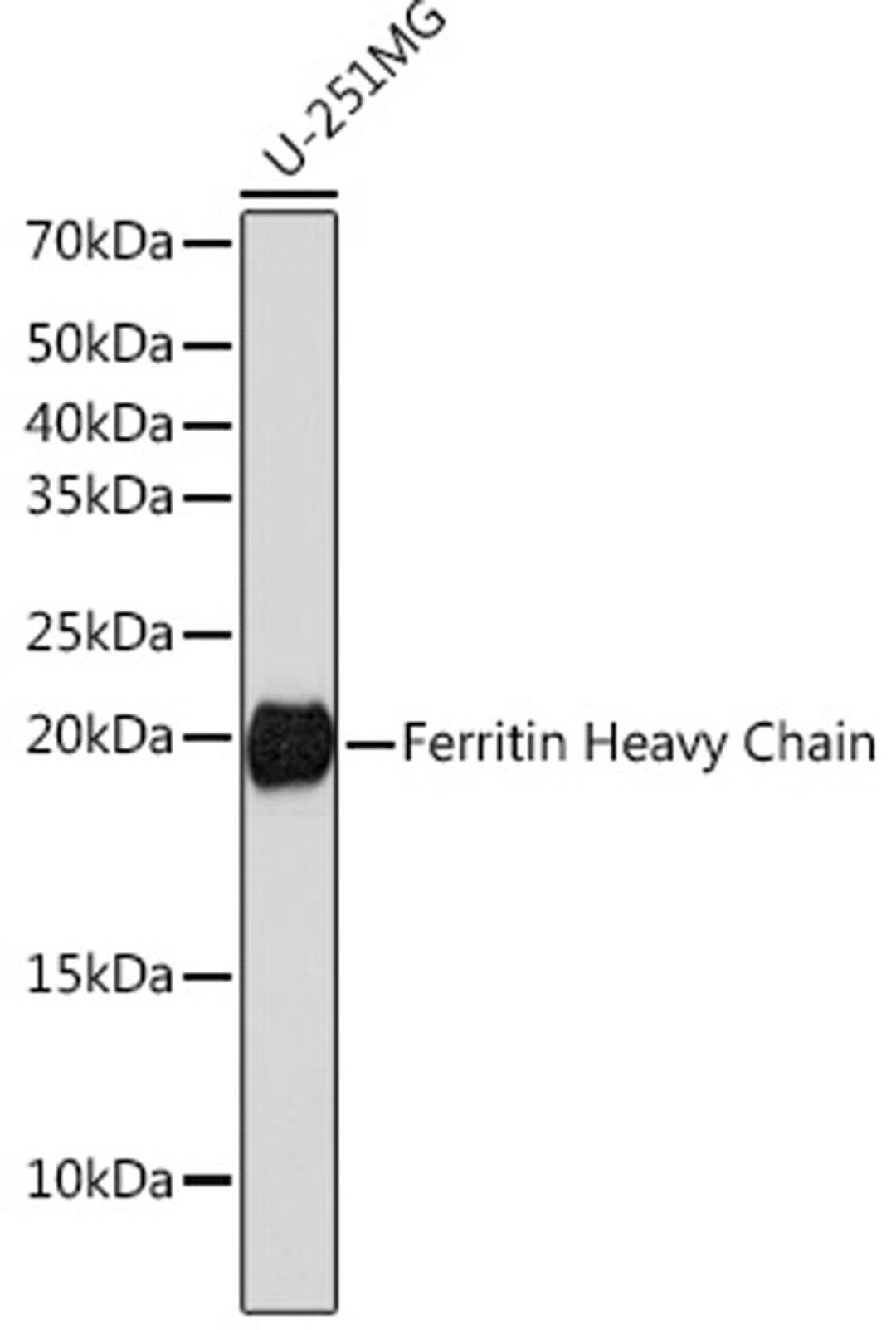 Western blot - Ferritin Heavy Chain antibody (A19544)