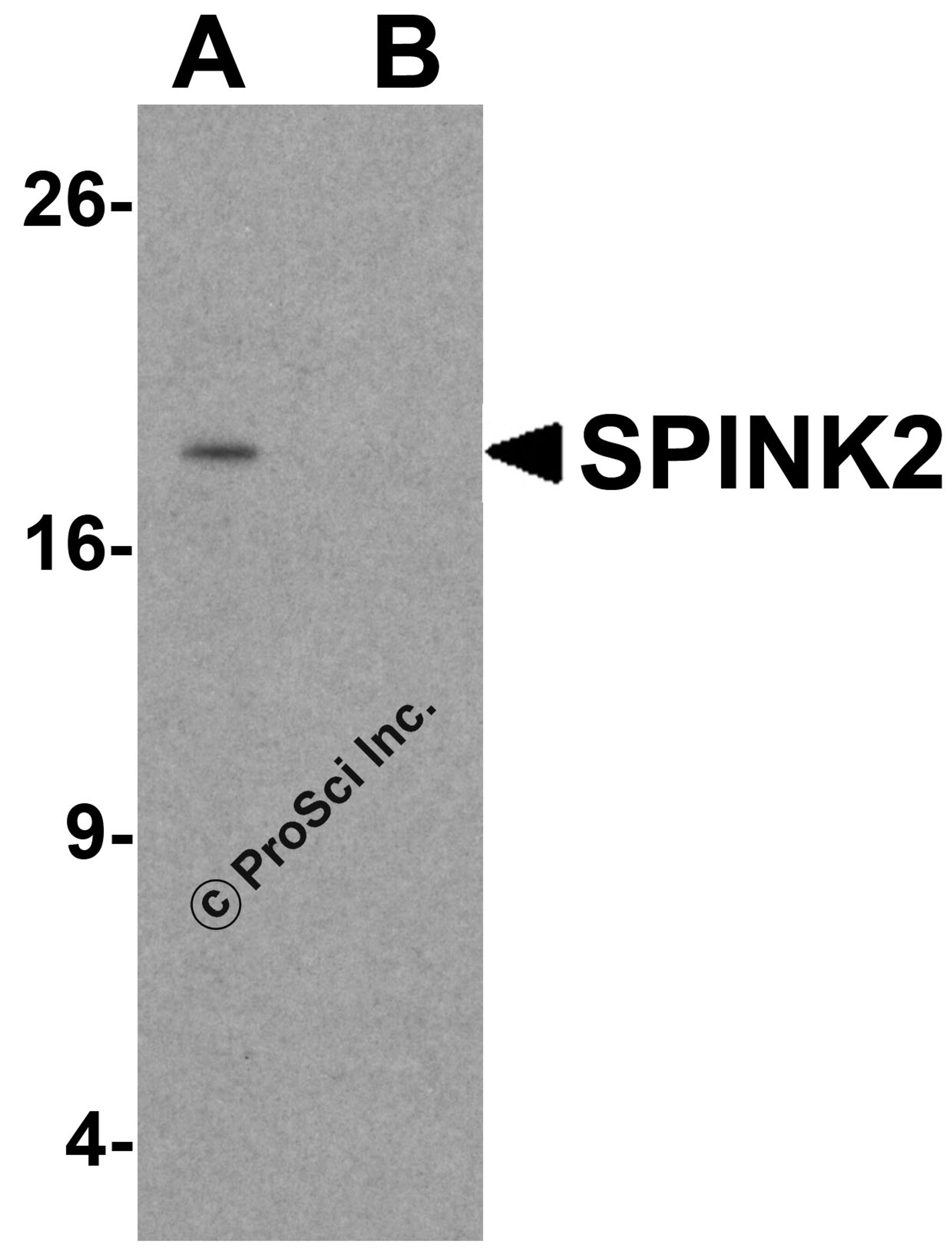 Western blot analysis of SPINK2 in human testis tissue lysate with SPINK2 antibody at 1 μg/mL in (A) the absence and (B) the presence of blocking peptide.