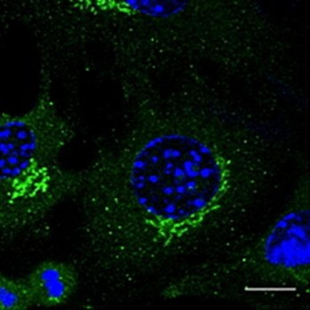 Confocal immunofluoroscence analysis of B6 cells using Rab3 antibody.