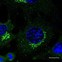 Confocal immunofluoroscence analysis of B6 cells using Rab3 antibody.