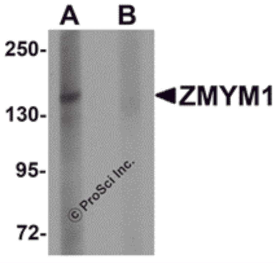 Western blot analysis of ZMYM1 in rat lung tissue lysate with ZMYM1 antibody at 1 μg/mL in (A) the absence and (B) the presence of blocking peptide.