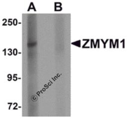 Western blot analysis of ZMYM1 in rat lung tissue lysate with ZMYM1 antibody at 1 μg/mL in (A) the absence and (B) the presence of blocking peptide.