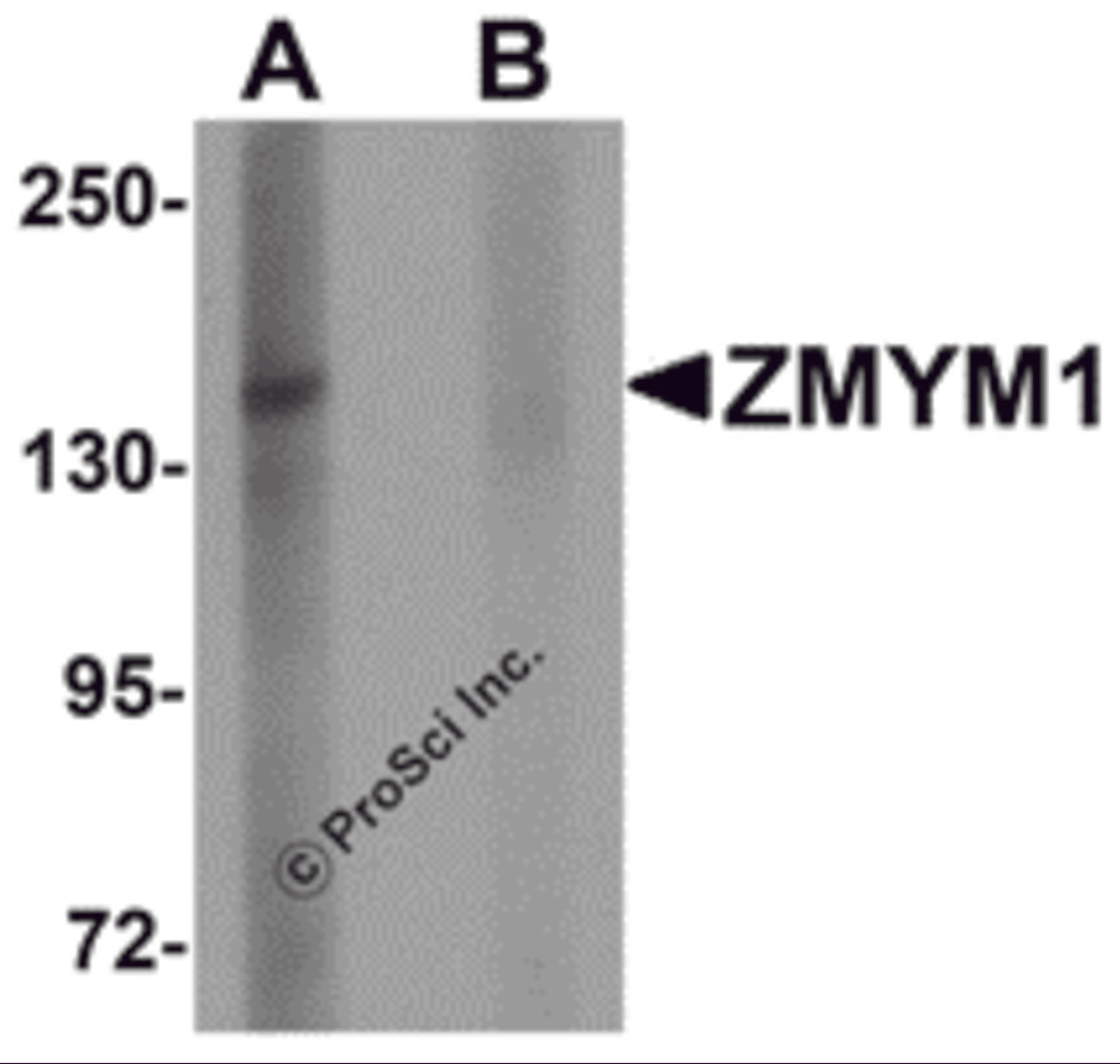Western blot analysis of ZMYM1 in rat lung tissue lysate with ZMYM1 antibody at 1 μg/mL in (A) the absence and (B) the presence of blocking peptide.