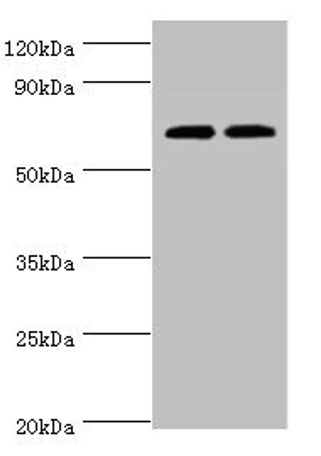Western blot. All lanes: APBB1IP antibody at 4ug/ml. Lane 1: HL60 whole cell lysate. Lane 2: Rat spleen tissue. Secondary. Goat polyclonal to rabbit IgG at 1/10000 dilution. Predicted band size: 74, 19 kDa. Observed band size: 74 kDa. 
