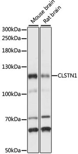 Western blot - CLSTN1 antibody (A15405)