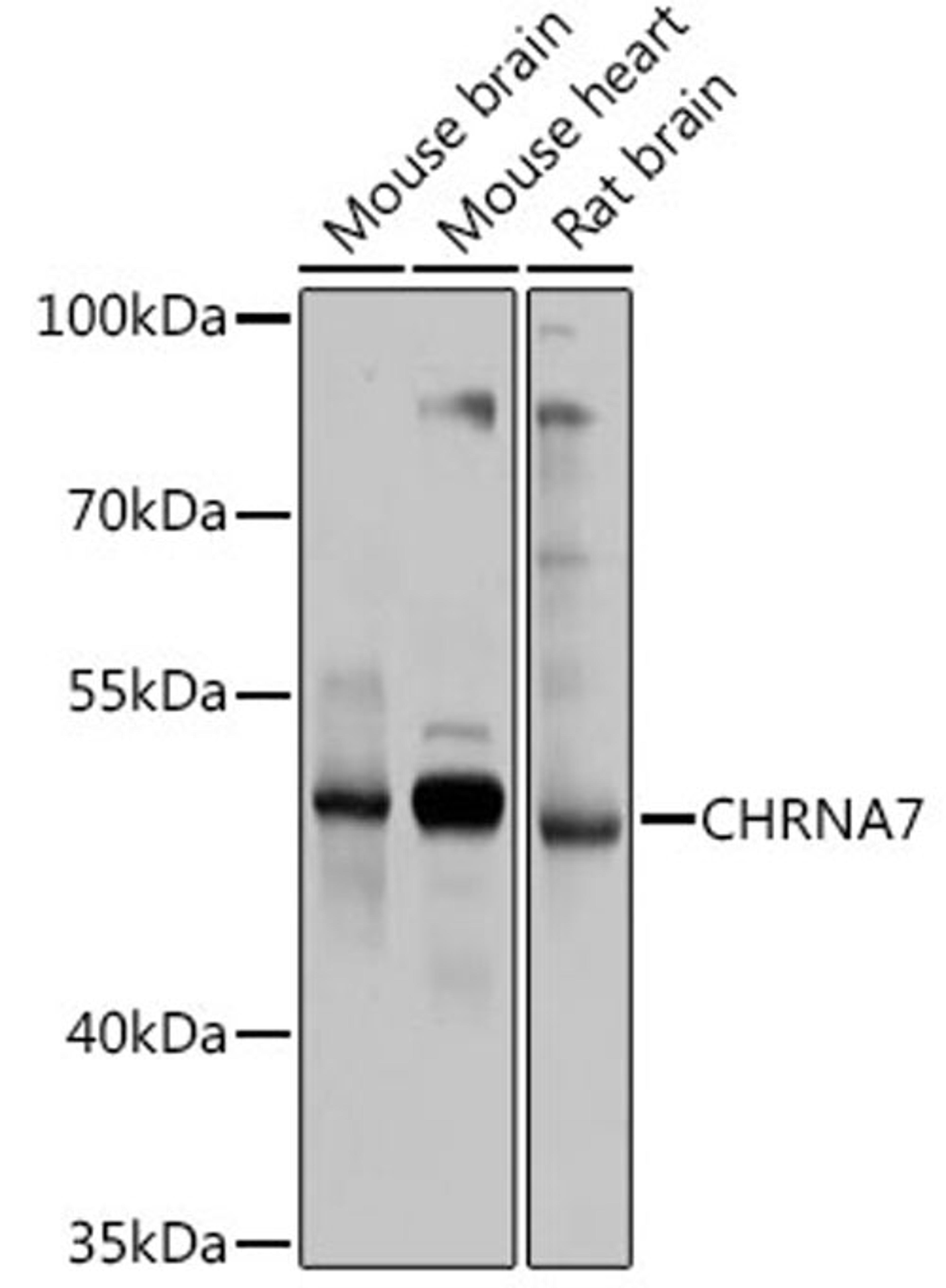 Western blot - CHRNA7 antibody (A1588)