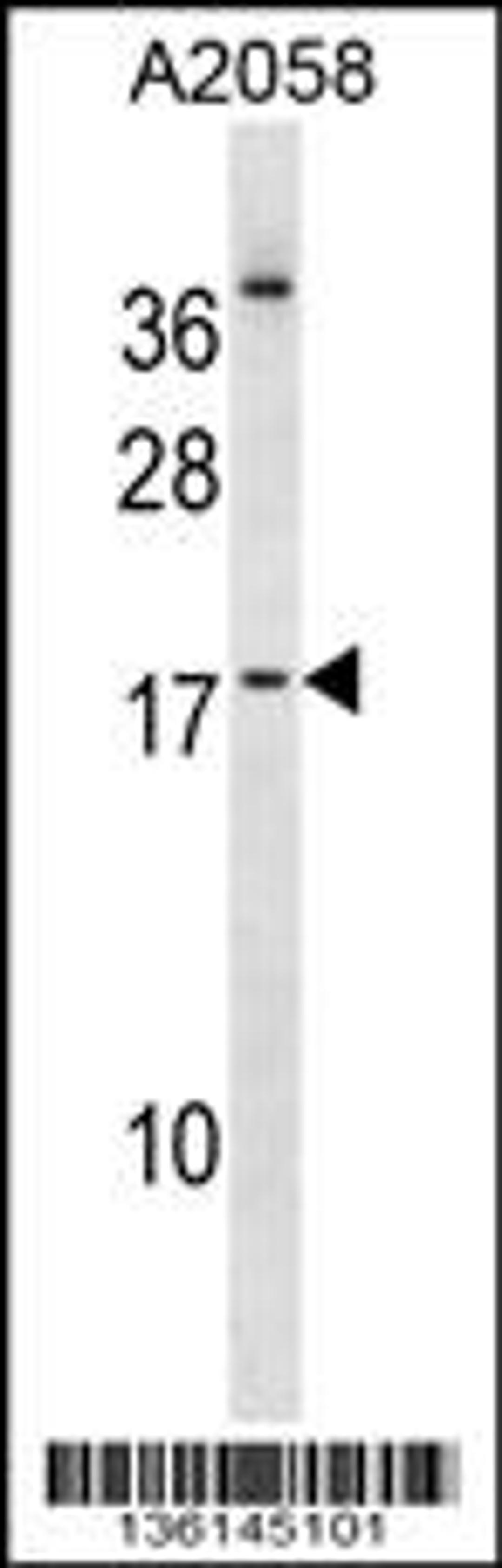 Western blot analysis in A2058 cell line lysates (35ug/lane).