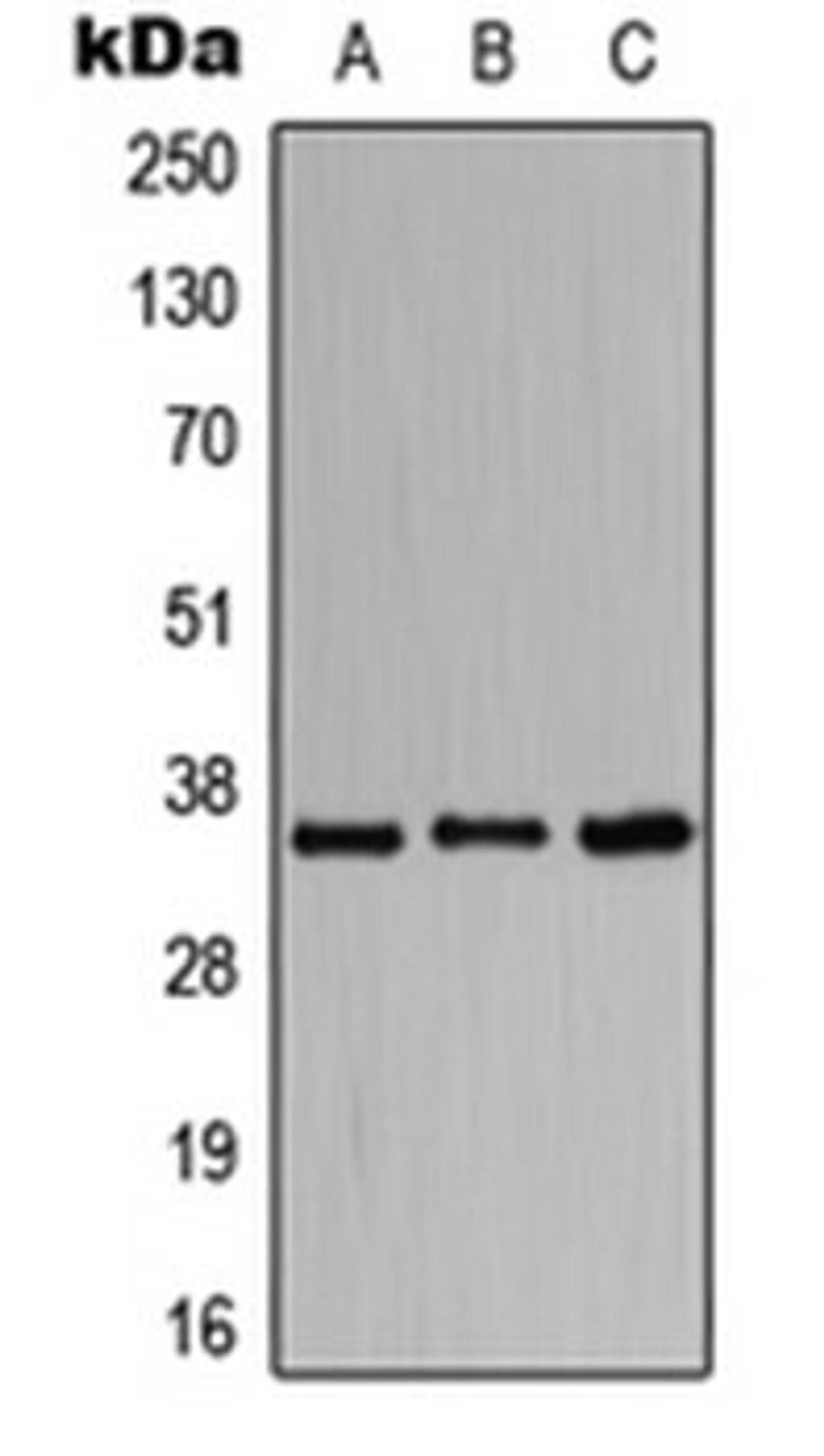 Western blot analysis of HeLa (Lane 1), Raw264.7 (Lane 2), H9C2 (Lane 3) whole cell lysates using BST1 antibody