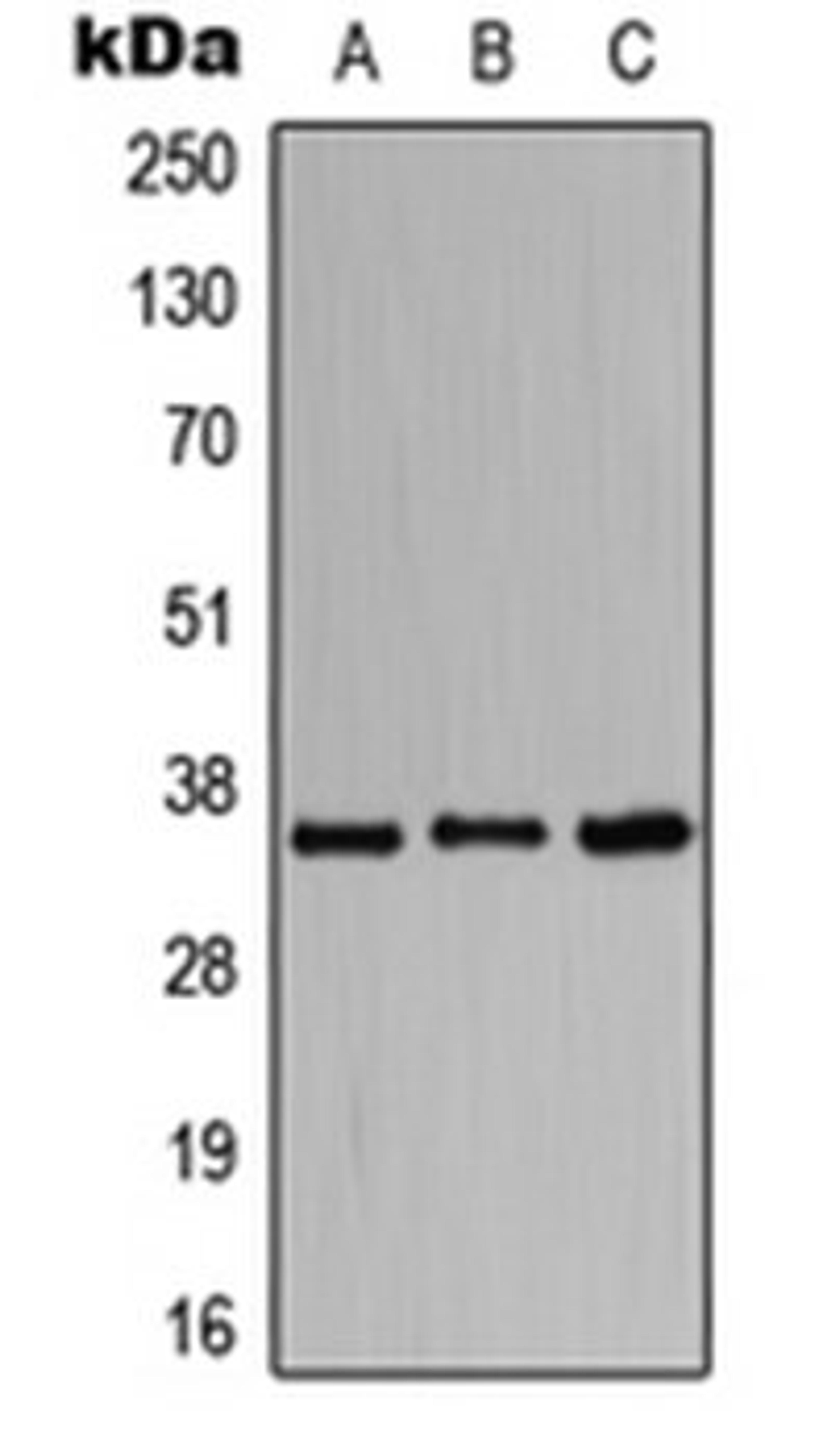 Western blot analysis of HeLa (Lane 1), Raw264.7 (Lane 2), H9C2 (Lane 3) whole cell lysates using BST1 antibody