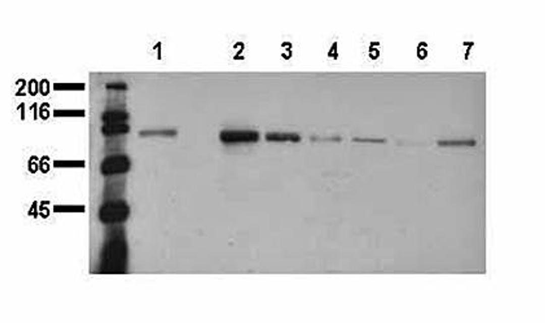 Western blot analysis of Catenin, beta antibody in A431 (1-40)(Lane1),A480 (1-42)(Lane2),SW620 (1-43)(Lane3),HT29 (Lane4),MCF7 (Lane5),MDA-MB231 (Lane6),T47D (Lane7) lysate